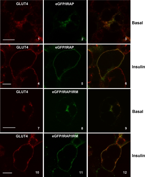 FIGURE 11.