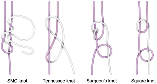 Biomechanical Comparison of 1.2-mm Suture Tape, 2.0-mm Suture Tape, and ...