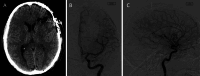 FIG. 5.