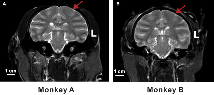 Figure 3