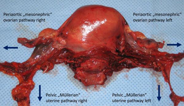 Figure 11