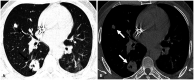 Fig. 14