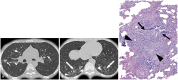 Fig. 16
