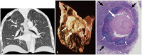 Fig. 18