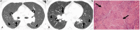 Fig. 10