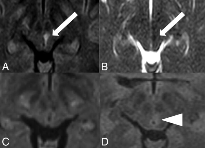 Fig 3.