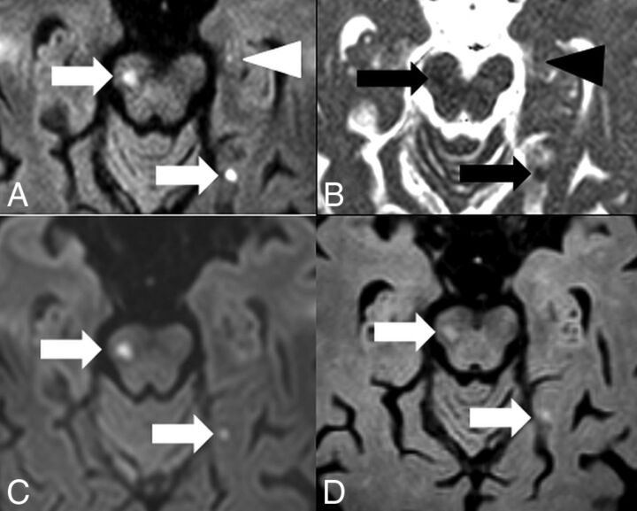 Fig 2.