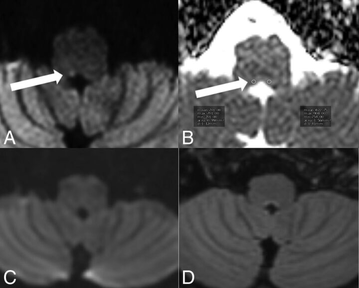 Fig 6.