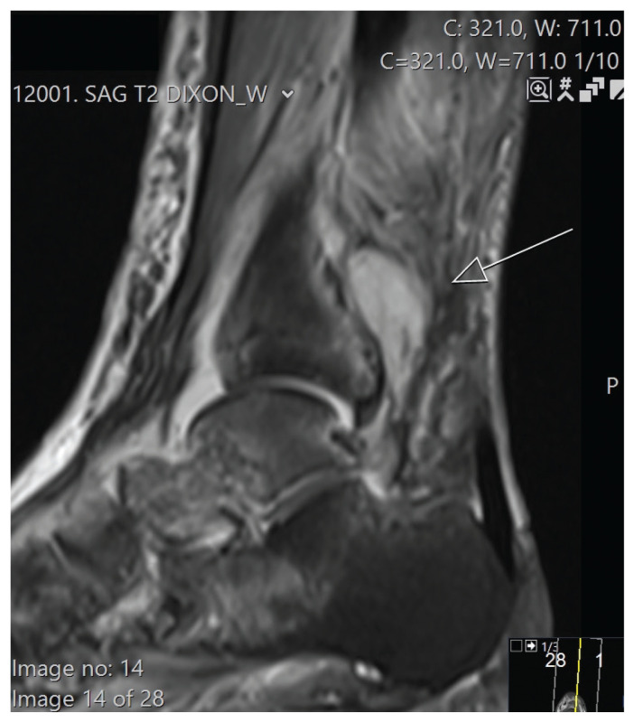 Figure 2: