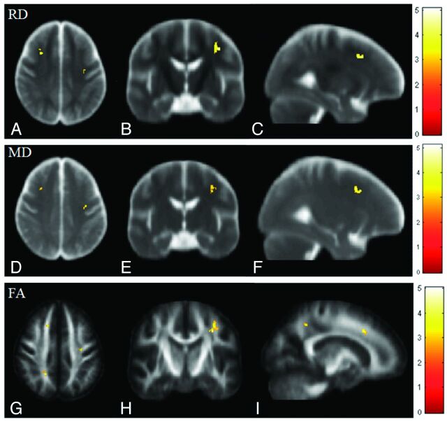 Fig 3.