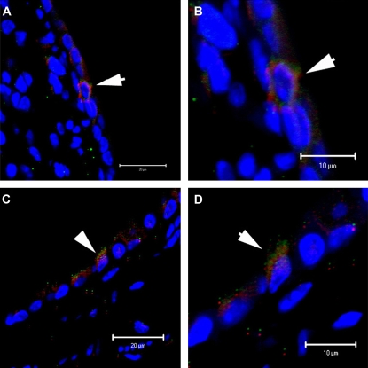 Figure 11.