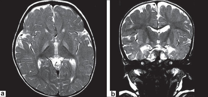 Figure 1a and b