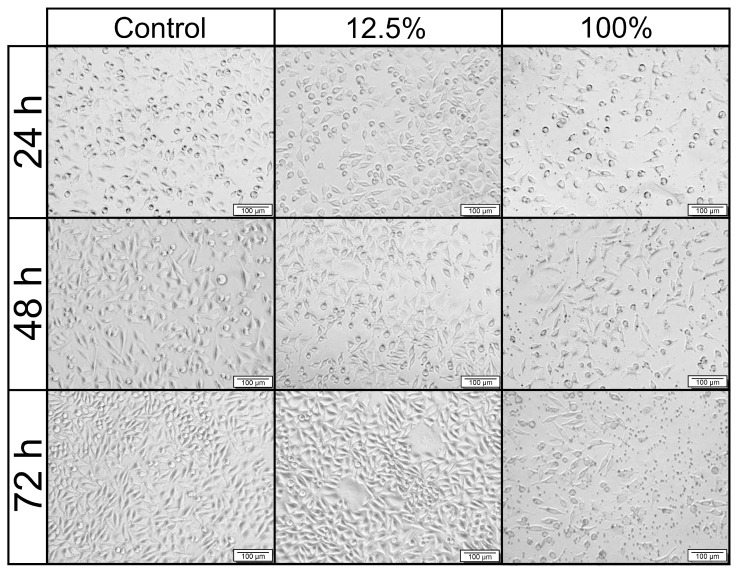 Figure 14