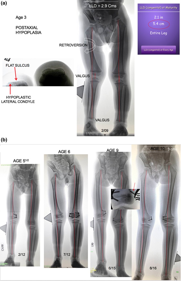 Fig. 2