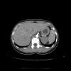 <b>FIG. 1.</b>