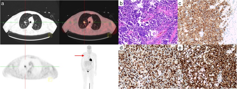 Fig. 2