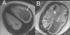 Figure 2 (A,B)