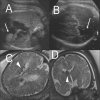 Figure 4 (A-D)
