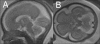 Figure 1 (A,B)