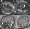 Figure 6 (A-D)
