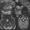 Figure 7 (A-D)