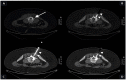 Fig 5