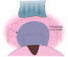 Fig. 11B