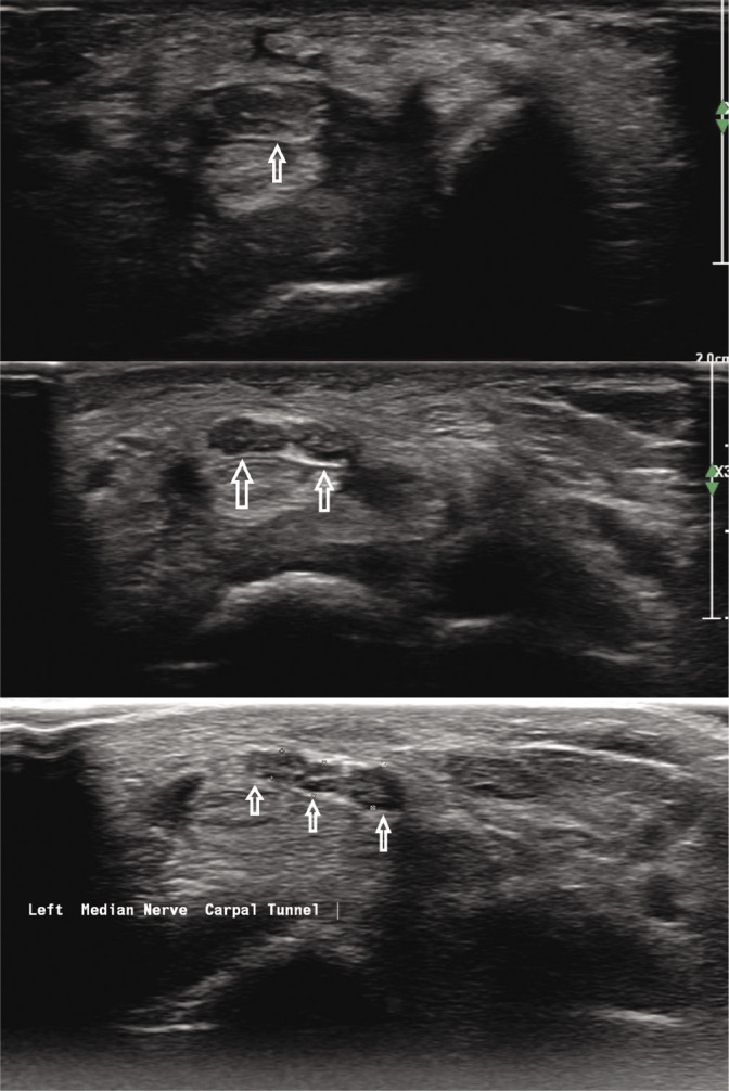 Fig. 5.