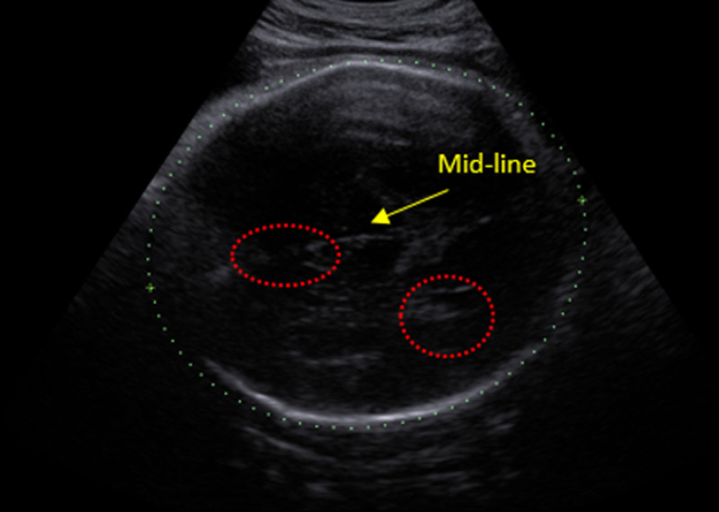 Fig. 2