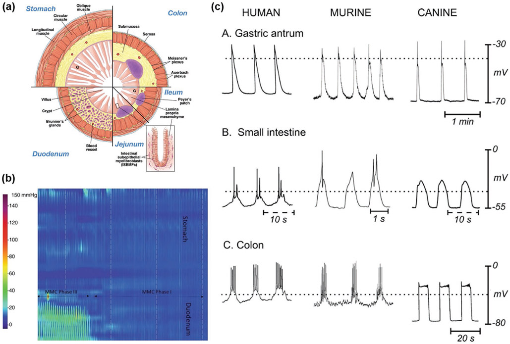 Figure 11.