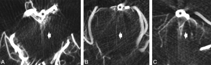 Fig 3.