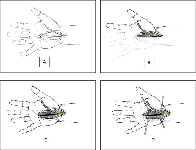 Fig. 3: