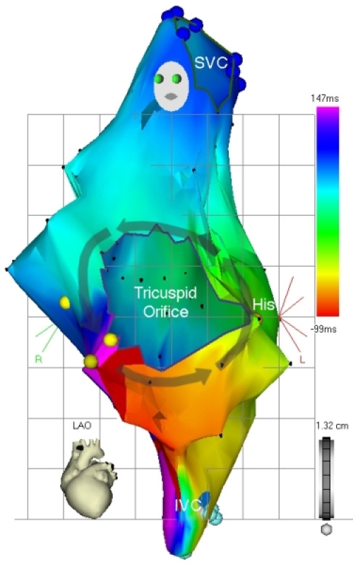 Figure 15