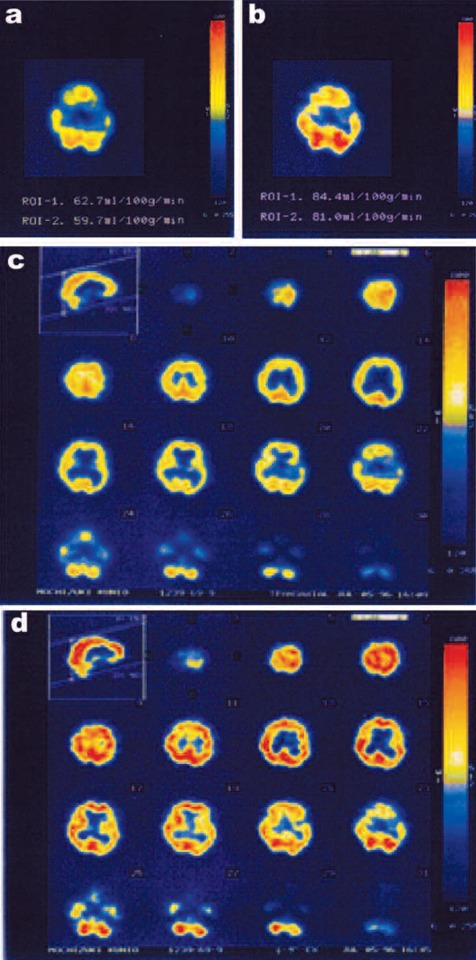 Fig 12: