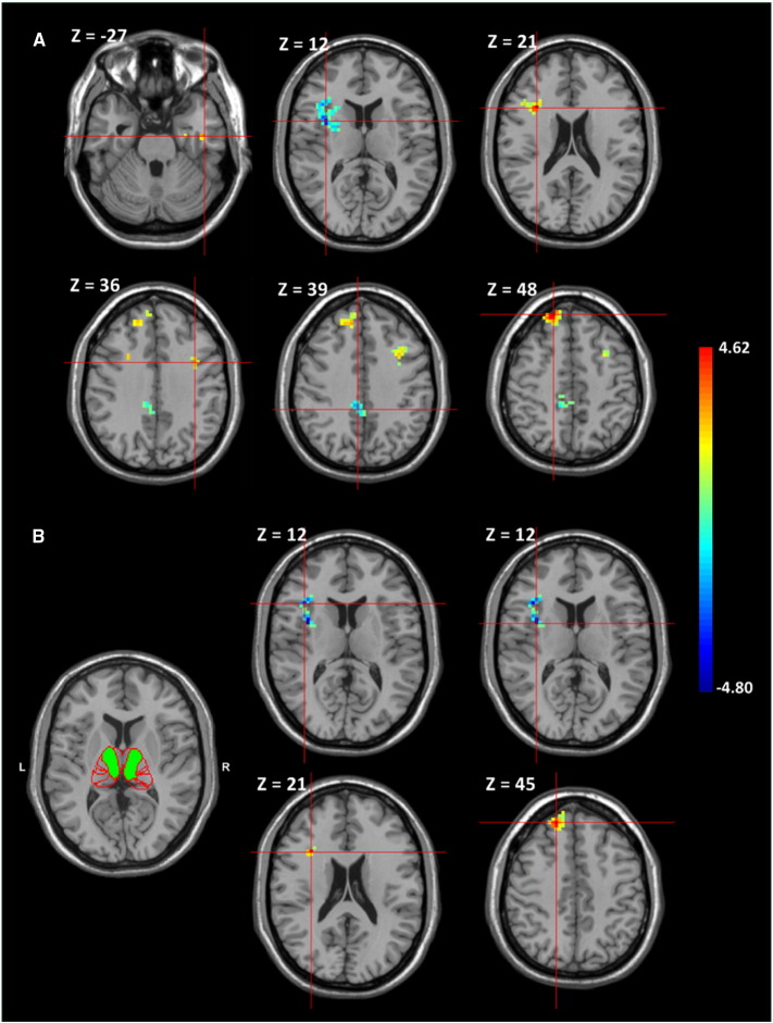 Fig. 3