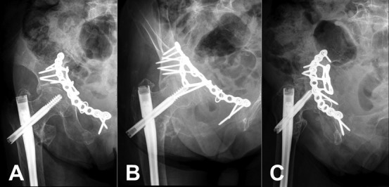 Fig. 8