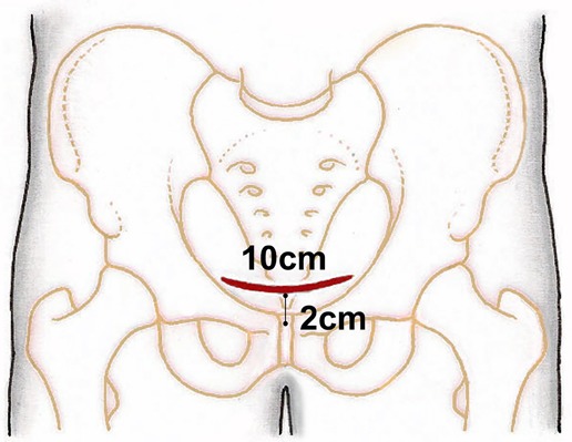 Fig. 3-A