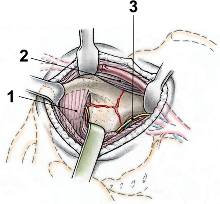 Fig. 4-C