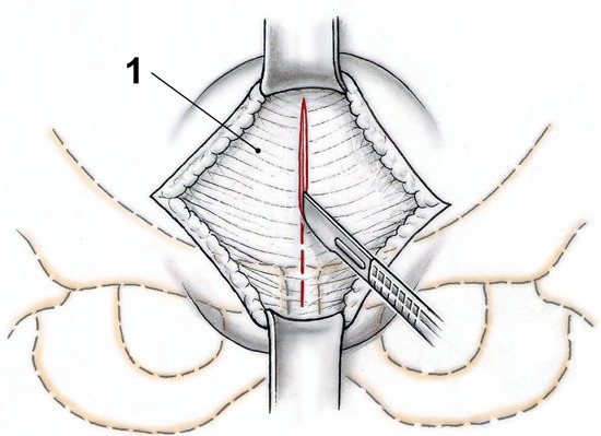 Fig. 3-B