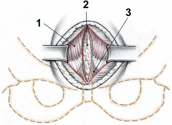 Fig. 3-C