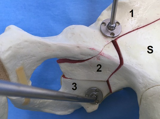 Fig. 4-I