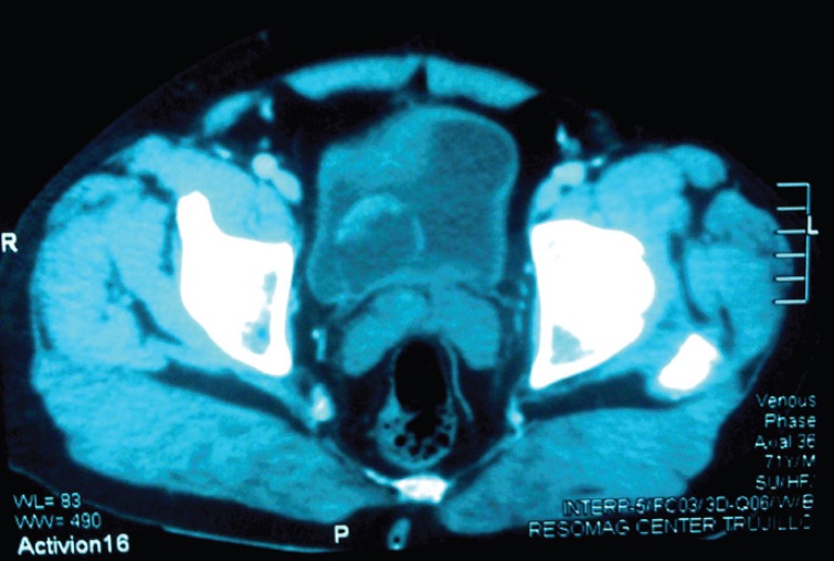 Figure 3.