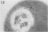 496