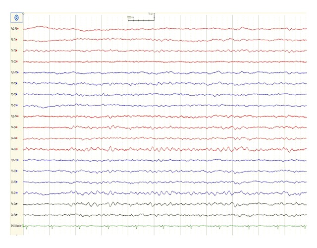 Figure 2.