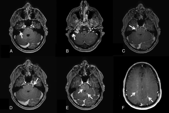 Fig 1.