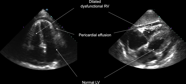 Figure 4