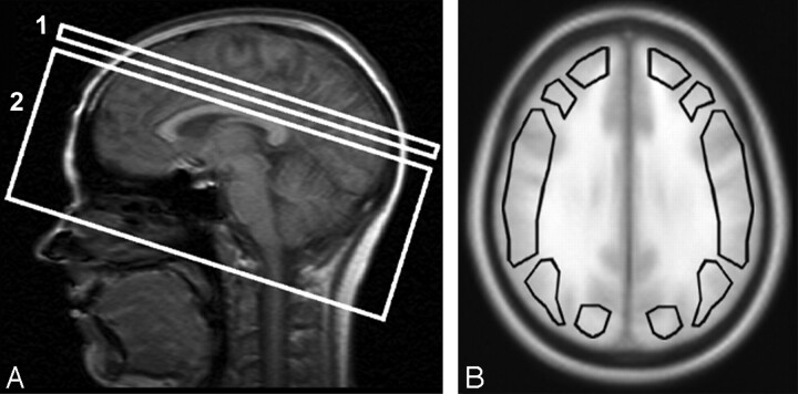 Fig 1.