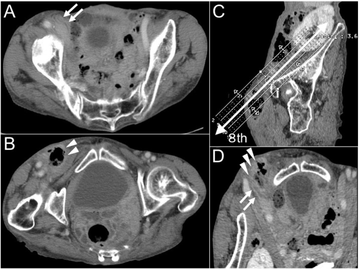 Fig. 2