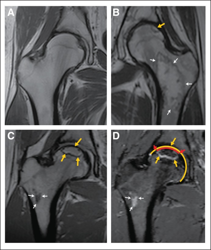 Fig 2.