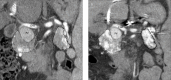 Figure 1. a, b